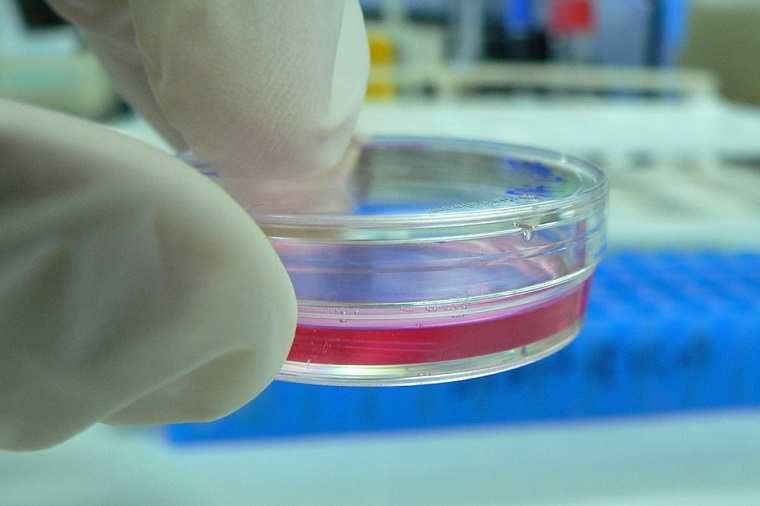Culturing cells in the lab (photo by Kaibara87, CC BY 2.0) 