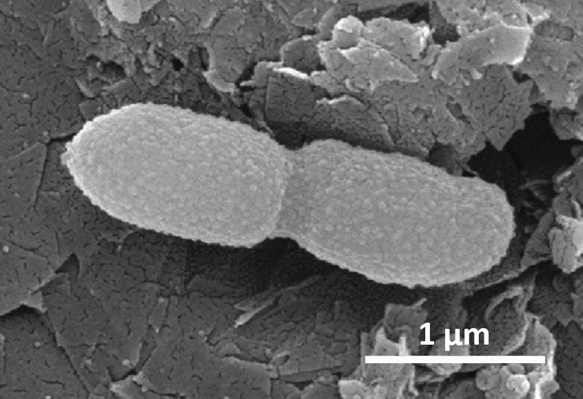 An Escherichia coli bacterium undergoing cell division (photo courtesy A. Berezuk)