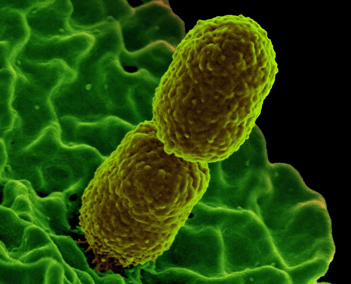 The bacterium Klebsiella pneumonia (photo by NIAID, CC BY 2.0)