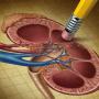 picture of a kidney diagram being erased by a pencil