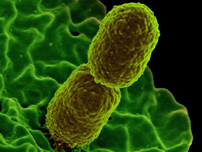 The bacterium Klebsiella pneumonia (photo by NIAID, CC BY 2.0)